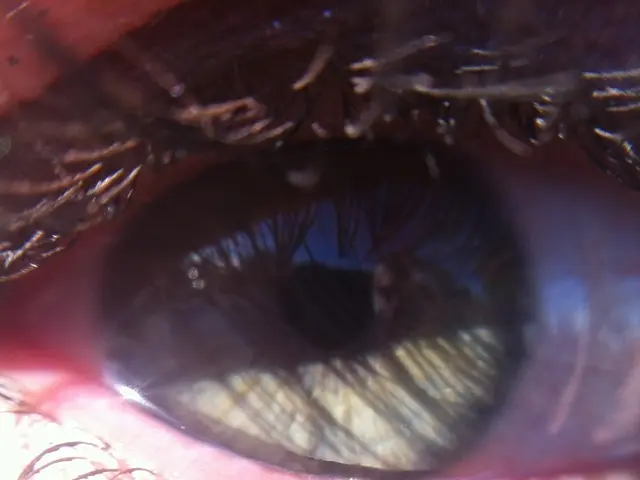 Vision Specialist, Mr. Spex, Sets To Begin Training in 2025, Marking an Investment in the Future of...